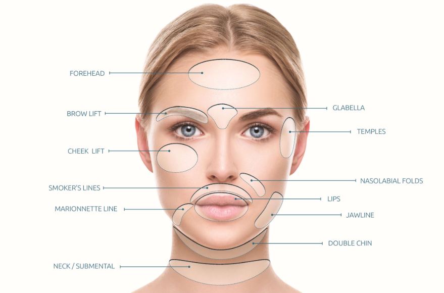 PDO Thread Treatment Areas